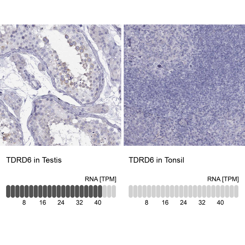 Anti-TDRD6 Antibody