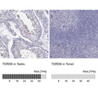 Anti-TDRD6 Antibody