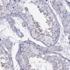 Immunohistochemical staining of human testis shows high expression.
