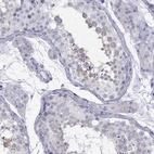 Immunohistochemical staining of human testis shows high expression.