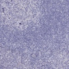 Anti-TDRD6 Antibody