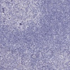 Immunohistochemical staining of human tonsil shows low expression as expected.
