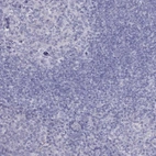 Immunohistochemical staining of human tonsil shows low expression as expected.