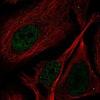 Anti-PPP1R3F Antibody