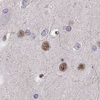 Immunohistochemical staining of human cerebral cortex shows nuclear positivity in neuronal cells.