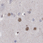 Anti-BCL11A Antibody