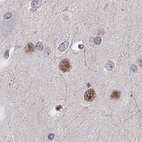 Immunohistochemical staining of human cerebral cortex shows nuclear positivity in neuronal cells.