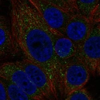 Anti-MTMR1 Antibody