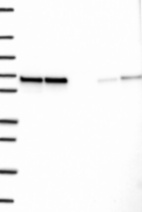 Anti-CCDC47 Antibody