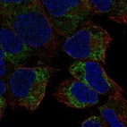 Anti-PREX2 Antibody