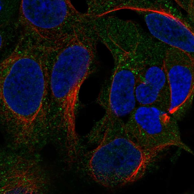 Anti-CCDC22 Antibody