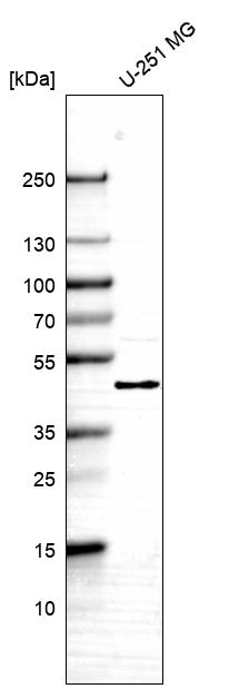 Anti-TBC1D13 Antibody