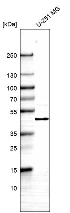 Anti-TBC1D13 Antibody
