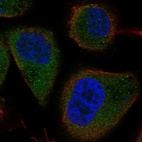 Immunofluorescent staining of human cell line PC-3 shows localization to cytosol.