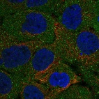 Anti-KHDC1L Antibody