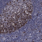 Anti-CDCA5 Antibody