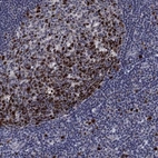 Immunohistochemical staining of human tonsil shows high expression.