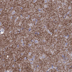 Anti-ADORA2A Antibody