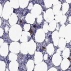 Immunohistochemical staining of human bone marrow shows strong cytoplasmic positivity in hematopoietic cells.