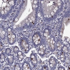 Immunohistochemical staining of human duodenum shows strong cytoplasmic positivity in enteroendocrine cells.
