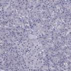Immunohistochemical staining of human pancreas shows no positivity in exocrine glandular cells as expected.