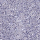 Immunohistochemical staining of human pancreas shows no positivity in exocrine glandular cells as expected.