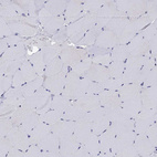 Immunohistochemical staining of human skeletal muscle shows no positivity in myocytes as expected.