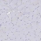 Immunohistochemical staining of human skeletal muscle shows no positivity in myocytes as expected.