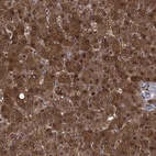 Immunohistochemical staining of human liver shows high expression.
