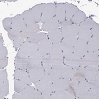 Immunohistochemical staining of human skeletal muscle shows low expression as expected.