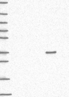 Lane 1: Marker [kDa] 250, 130, 95, 72, 55, 36, 28, 17, 10 | Lane 2: RT4 | Lane 3: U-251 MG | Lane 4: Human Plasma | Lane 5: Liver | Lane 6: Tonsil