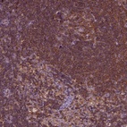 Immunohistochemical staining of human lymph node shows high expression.