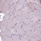 Immunohistochemical staining of human skeletal muscle shows low expression as expected.