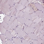 Immunohistochemical staining of human skeletal muscle shows low expression as expected.