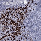 Anti-IRF5 Antibody