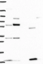 Lane 1: Marker [kDa] 250, 130, 95, 72, 55, 36, 28, 17, 10 | Lane 2: RT4 | Lane 3: U-251 MG | Lane 4: Human Plasma | Lane 5: Liver | Lane 6: Tonsil