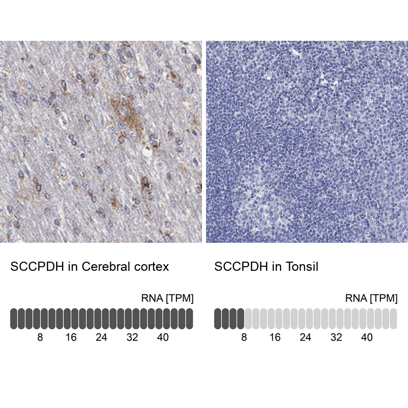 Anti-SCCPDH Antibody