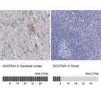 Anti-SCCPDH Antibody