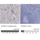 Anti-SCCPDH Antibody