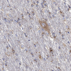 Immunohistochemical staining of human cerebral cortex shows high expression.