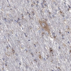 Immunohistochemical staining of human cerebral cortex shows high expression.