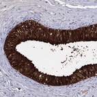 Immunohistochemical staining of human epididymis shows high expression.