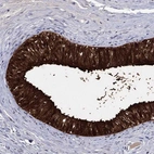 Immunohistochemical staining of human epididymis shows high expression.