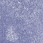 Immunohistochemical staining of human tonsil shows low expression as expected.