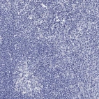 Immunohistochemical staining of human tonsil shows low expression as expected.