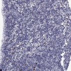 Immunohistochemical staining of human lymph node shows low expression as expected.