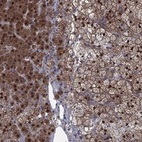 Anti-IAH1 Antibody