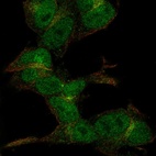 Anti-ZC3H6 Antibody