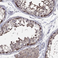 Anti-PDZD2 Antibody