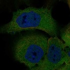 Immunofluorescent staining of human cell line EFO-21 shows localization to plasma membrane & cytosol.